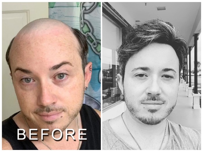 How to Distinguish Toupee And Wig